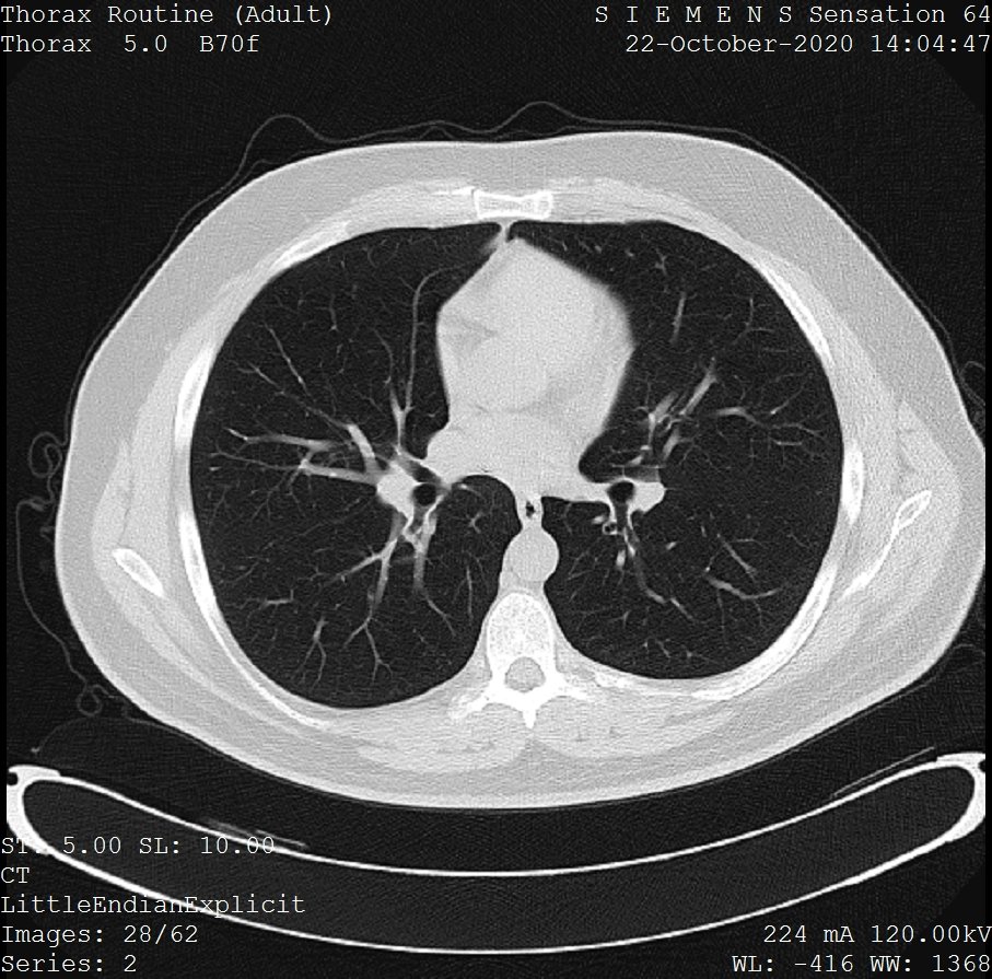 Medical imaging equipment used for chest screening